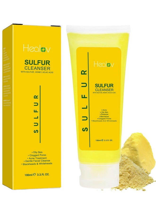 Sulfur Soap Sulfur Face & Body Wash For Acne Sulphur Exfoliating Facial Cleanser Absorbs Excess Oil Reduces Breakouts & Cleanses Skin Natural Cystic Acne Rosacea Skin Care Treatment - pzsku/ZF217C18B369493661A4EZ/45/_/1719246957/79ac9408-cec1-4624-a49f-c6d7b41f7c4f