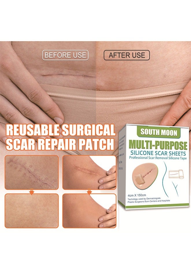 SOUTH MOON Silicone Scar Tape Silicone Strips Reusable, Professional Scar Removal Sheets for C-Section Surgery Burn Keloid Acne et - Image 4