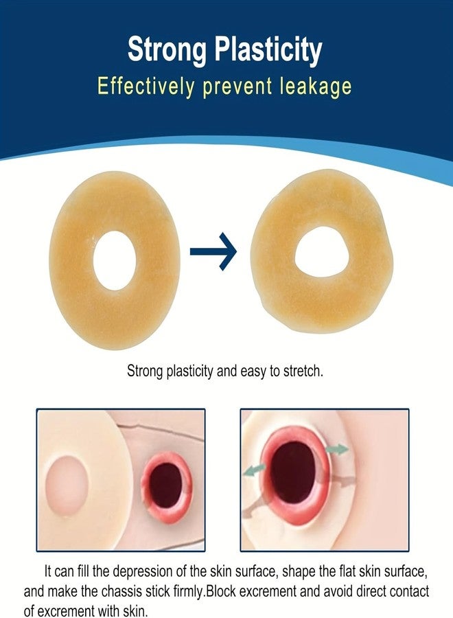 KONWEDA 10 PCS Ostomy Barrier Rings, 2mm Thickness Moldable Colostomy Rings, Medical Grade Hydrocolloid Adhesive Barrier Rings Better Seal for Ostomy Supplies (Box of 10) - Image 5