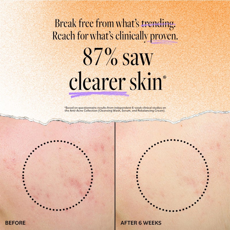 derma-e DERMA E Acne Oil Control Face Moisturizer, 2 Oz, Matte Moisturizer with Salicylic Acid, Tea Tree Oil & Aloe Vera, Face Cream Rebalances Sebum Production & Prevents Blemishes, Redness & Breakouts 2 Oz - Image 3