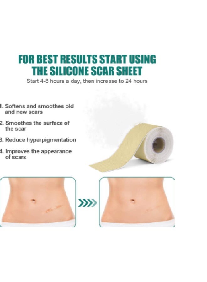 CICA Silicone Scar Sheet Prevents And Treats Scars 4cm X 150cm - Image 3