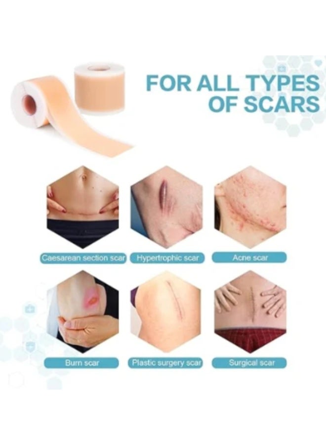 CICA Silicone Scar Sheet Prevents And Treats Scars 4cm X 150cm - Image 2