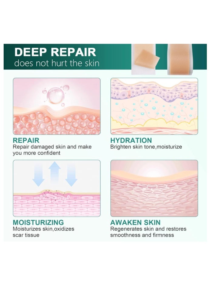 CICA Silicone Scar Sheet Prevents And Treats Scars 4cm X 150cm - Image 5