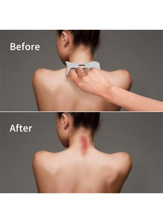 سيسلي أداة مساج جواشا لتحسين الأنسجة الرخوة والعلاج الطبيعي من الفولاذ المقاوم للصدأ للظهر والساقين والأذرع والرقبة والكتف - Image 5