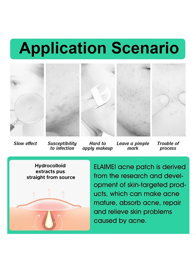 Elaimei - 10 Facial Acne Patches - Hydrocolloid Acne Patches to Cover Pimples and Blemishes - Acne Patches for Skin Care - Image 1