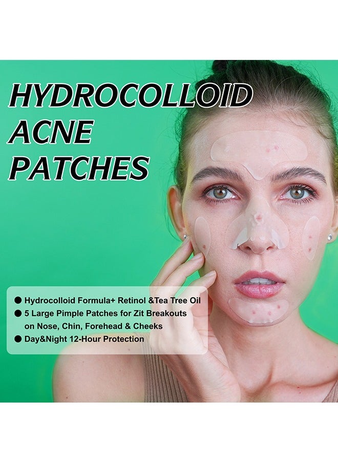 Elaimei - 10 Facial Acne Patches - Hydrocolloid Acne Patches to Cover Pimples and Blemishes - Acne Patches for Skin Care - Image 1