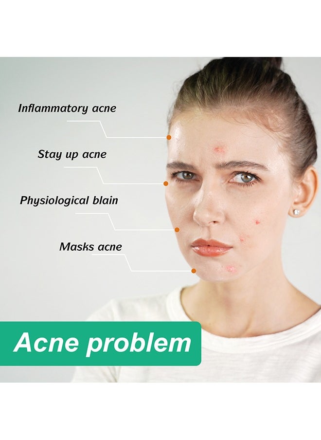 Elaimei - 10 Facial Acne Patches - Hydrocolloid Acne Patches to Cover Pimples and Blemishes - Acne Patches for Skin Care - Image 1