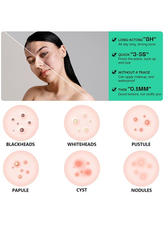 Elaimei - 10 Facial Acne Patches - Hydrocolloid Acne Patches to Cover Pimples and Blemishes - Acne Patches for Skin Care - Image 1