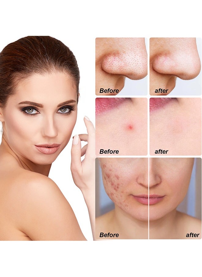 Elaimei - 10 Facial Acne Patches - Hydrocolloid Acne Patches to Cover Pimples and Blemishes - Acne Patches for Skin Care - Image 1
