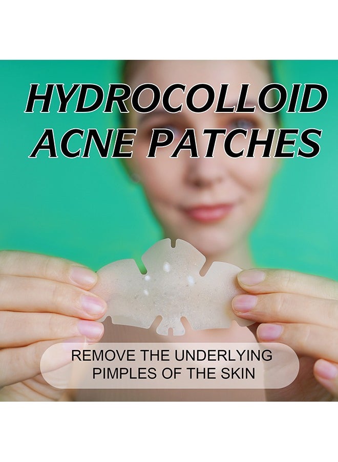 Elaimei - 10 Facial Acne Patches - Hydrocolloid Acne Patches to Cover Pimples and Blemishes - Acne Patches for Skin Care - Image 1