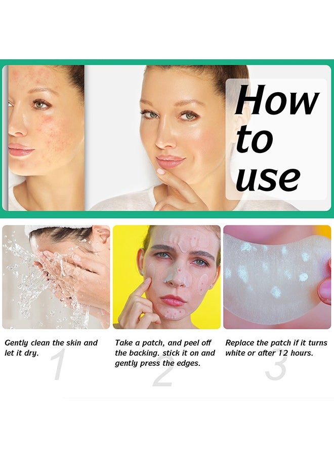 Elaimei - 10 Facial Acne Patches - Hydrocolloid Acne Patches to Cover Pimples and Blemishes - Acne Patches for Skin Care - Image 1