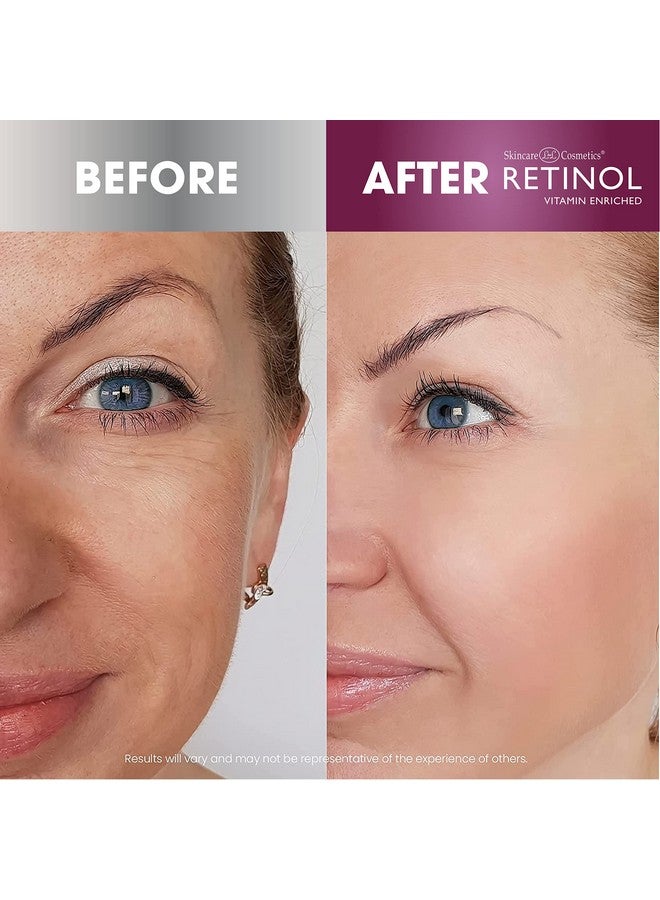 RETINOL Skincare Ldel Cosmetics Day Cream Broad Spectrum Spf 20 Moisturizes & Reduces Look Of Fine Lines Provides Protection From Daily Sun Exposure 1.7 Oz. - Image 5