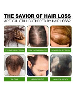 Jaysuing Hair Growth Serum and Lotion ,Hair Loss & Regrowth Treatments  - Image 3