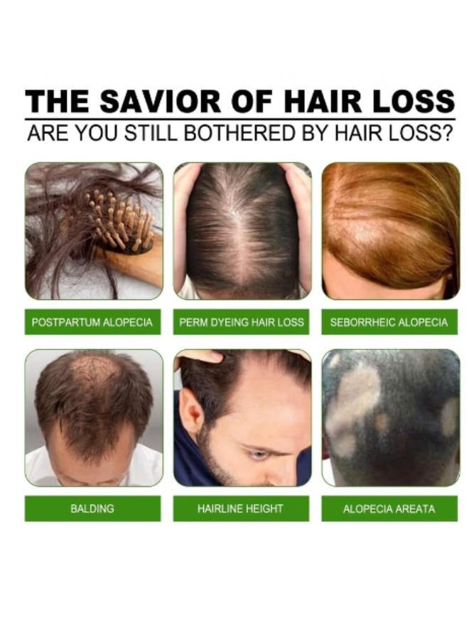 جايسوينغ مصل وغسول نمو الشعر وعلاجات تساقط الشعر وإعادة نموه - Image 3