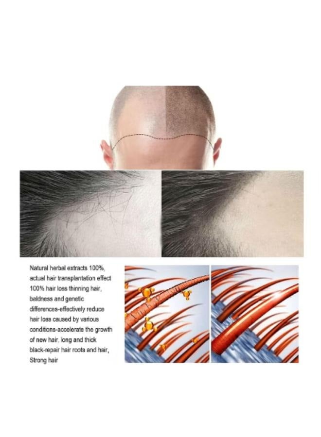 جايسوينغ مصل وغسول نمو الشعر وعلاجات تساقط الشعر وإعادة نموه - Image 4