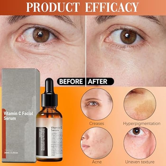 warmow 2 PCS Vitamin C Facial Serum Essence, Skin Care, Hydration, Skin Moisturized, 30 ml, 1.01oz - Image 5