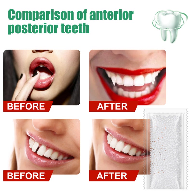 100g Teeth Solid Glue White Granules Complement Teeth Multifunctional Denture Solid Glue Regain Smile - Image 5