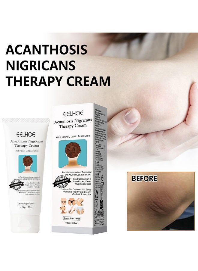 EELHOE Acanthosis Nigricans Therapy Cream, Skin Whitening Cream, Bleaching Cream, Brightening Cream, Skin Lightening Dark Spot Remover For Body Areas, Moisturizing And Hydrating Body Care For Underarm, Neck, Armpit, Knees, Elbows, 50G - Image 2