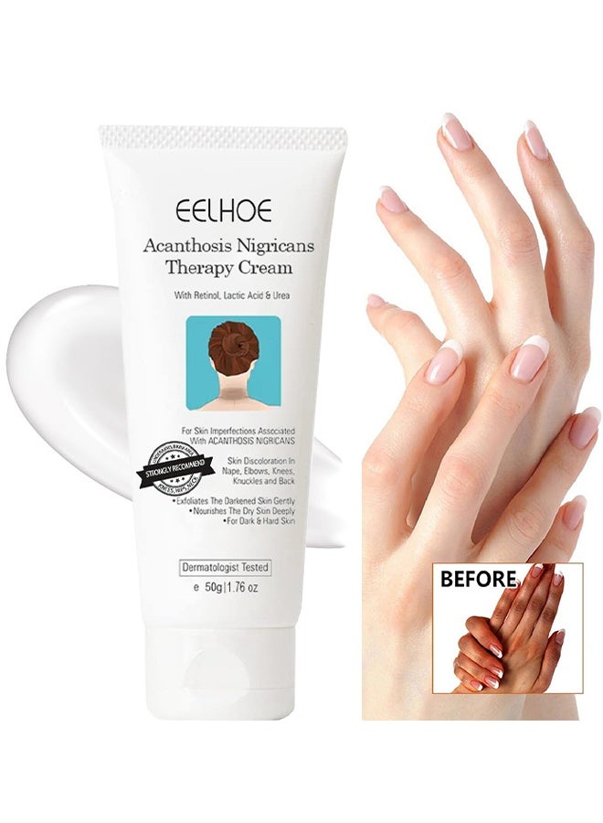EELHOE Acanthosis Nigricans Therapy Cream, Skin Whitening Cream, Bleaching Cream, Brightening Cream, Skin Lightening Dark Spot Remover For Body Areas, Moisturizing And Hydrating Body Care For Underarm, Neck, Armpit, Knees, Elbows, 50G - Image 1