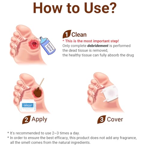LMNOOP مرهم LMNOOP® لعلاج قرح الفراش، كريم عناية بالجروح بقوة قصوى لحماية العدوى وإصلاح الجلد، شفاء سريع للجروح السكرية، قرح الضغط، قرح الوريد، الحروق، الجروح، الخدوش - Image 5