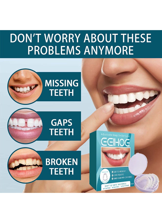 EELHOE Adjustable Snap On Dentures, Temporary Teeth Repair Kit Correct Denture Alignment For Temporary Teeth Replacement  - Image 5
