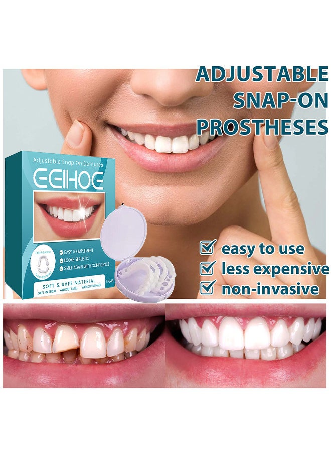 EELHOE - Adjustable Snap On Dentures, Temporary Teeth Repair Kit Correct Denture Alignment For Temporary Teeth Replacement - Image 1