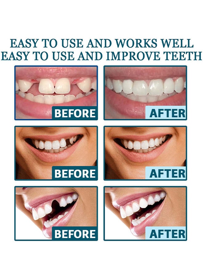EELHOE - Adjustable Snap On Dentures, Temporary Teeth Repair Kit Correct Denture Alignment For Temporary Teeth Replacement - Image 1