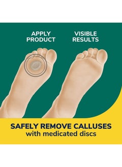 Dr. Scholl's مزيل مسامير القدم السميك للغاية، 4 قطع // يساعد على تليين مسامير القدم الصلبة وتخفيف الألم طوال اليوم  - Image 3