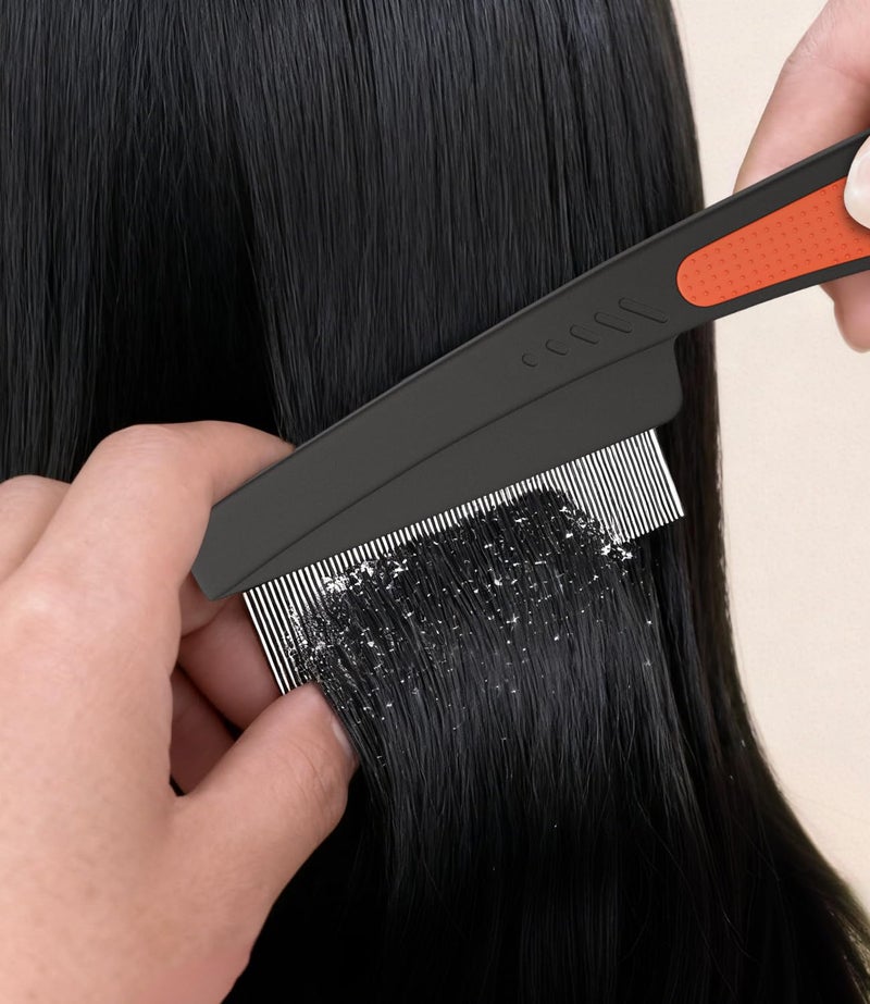 EHBELIF Self-Cleaning Dandruff Comb 2-Pack, Hollow Teeth Button-Release Scalp Detox, Fine Tooth 0.5mm & 2mm for Nits Buildup Removal, Women Men Kids, Stainless Steel Ergonomic Anti-Slip Hair Care Tool - Image 3