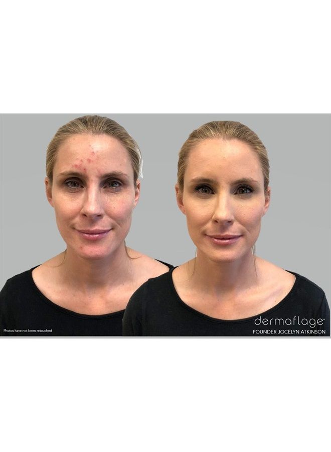 dermaflage كريم خافي العيوب المقاوم للماء، مكياج مقاوم للماء بتغطية كاملة، وعد تطابق اللون من ديرمافلاج، 6غ/.2أونصة - Image 2
