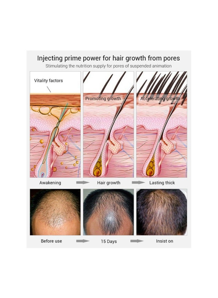 LANBENA Hair Growth Essential Spray 20ML 2 Pack - Image 5