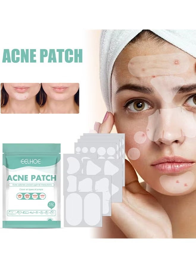 EELHOE Pimple Patches Acne Patches, 5 Sizes 132 Patches Pimple Patches For Face, Chin Or Body, Acne Treatment with Tea Tree And Salicylic Acid, Hydrocolloid Bandages For Acne Skin - Image 1