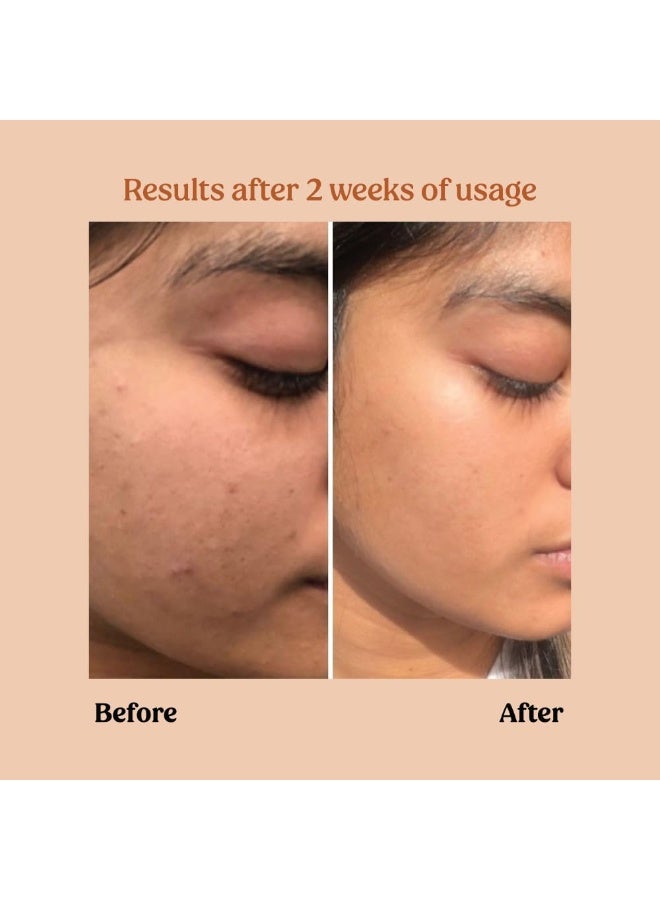 Vilvah Store Milk Powder Face Wash & Milk Drops Brightening Serum Combo | For Bright & Glowing Skin | All Skin Types | For Both Men & Women | Pack of 2 - Image 3