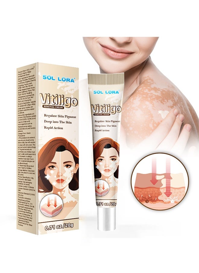 SOL LORA Vitiligo Removal Cream, Vitiligo Care Cream for Skin Vitiligo, Psoriasis, Leukoplakia, Reduces White Spots, Improve Skin Pigmentation Regulating 20g  - Image 1
