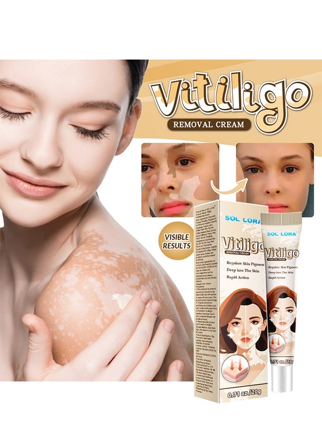 SOL LORA Vitiligo Removal Cream, Vitiligo Care Cream for Skin Vitiligo, Psoriasis, Leukoplakia, Reduces White Spots, Improve Skin Pigmentation Regulating 20g  - Image 2