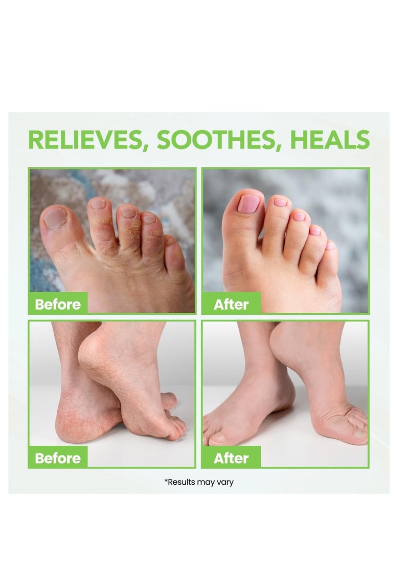 THENA Natural Wellness - Athletes Foot Balm Extra Strength, Athletes Foot Treatment Cream, Heals Dry Cracked Feet Heels Itchy Skin Nails Toenails Advanced Foot Care for Men Women - Image 1