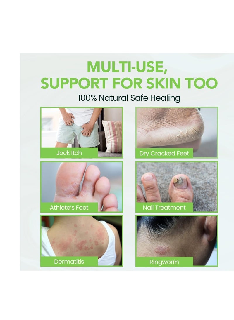 THENA Natural Wellness - Athletes Foot Balm Extra Strength, Athletes Foot Treatment Cream, Heals Dry Cracked Feet Heels Itchy Skin Nails Toenails Advanced Foot Care for Men Women - Image 1