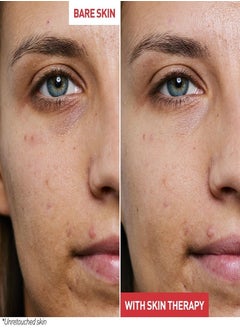 erborian Erborian Skin Therapy Night Oil-Serum 30ml – Nourishing & Revitalizing Skincare  - Image 2