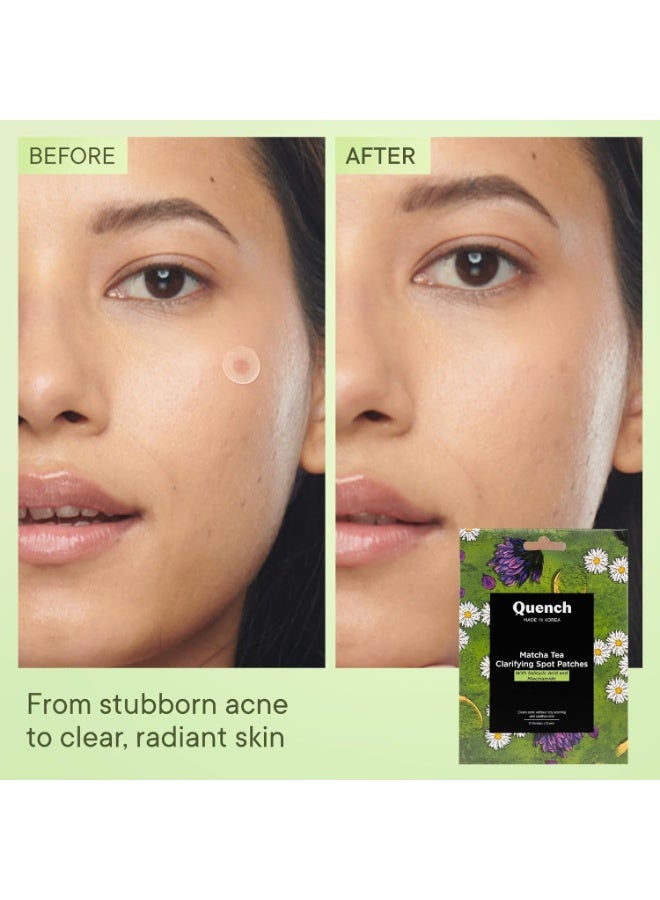 كوينش QUENCH BOTANICS لصقات الشاي الأخضر (ماتشا) المنقية لحب الشباب - 12 لصقة - Image 3