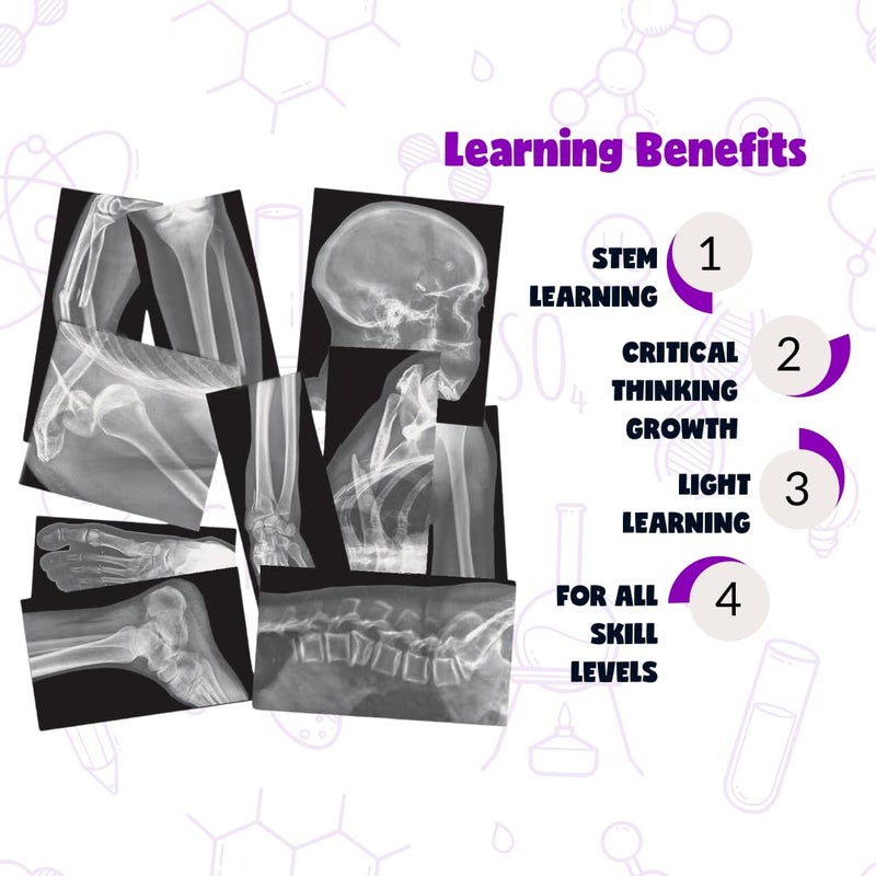 Roylco Broken Bones X-Ray Set, Projector Display Compatible, 15 X-Rays - Image 2