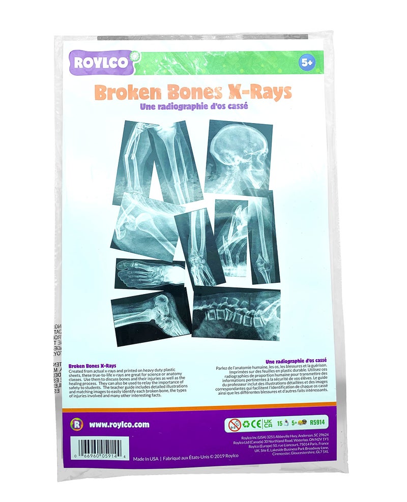 Roylco Broken Bones X-Ray Set, Projector Display Compatible, 15 X-Rays - Image 4