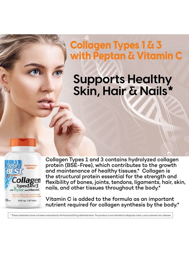 Doctor's Best Collagen Types 1 & 3 with Peptan, Non-GMO, Gluten Free, Soy Free, Supports Hair, Skin, Nails, Tendons & Bones, 1000 Mg, 540 Tablets - Image 1