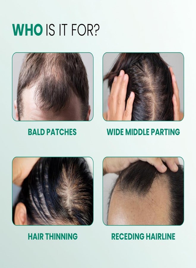 Dermalist Rosemary Hair Growth Advanced Serum Roll-On | With 3% Redensyl®, 4% AnaGain™ & 3% Baicapil™ | Easy to Use | Mess-free | Prevents Hair Fall & Stimulates Hair Follicles | For All Hair Types | 10ml - Image 3