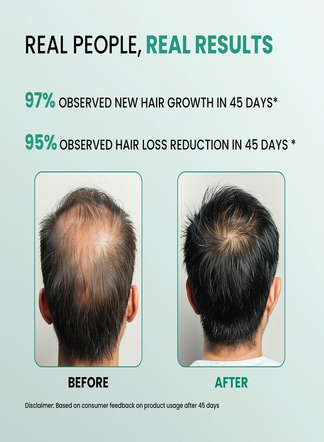 Dermalist Rosemary Hair Growth Advanced Serum Roll-On | With 3% Redensyl®, 4% AnaGain™ & 3% Baicapil™ | Easy to Use | Mess-free | Prevents Hair Fall & Stimulates Hair Follicles | For All Hair Types | 10ml - Image 4