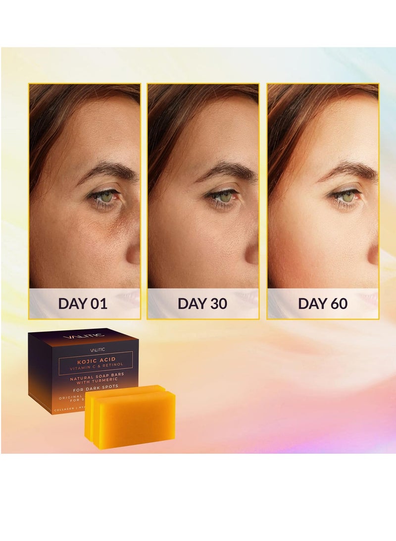 فاليتيك صابون حمض الكوجيك وفيتامين سي والريتينول، صابون لإزالة البقع الداكنة بالكركم، صابون ناعم ولطيف للعناية بالبشرة، مكونات آمنة وعضوية، صابون للجسم للعناية بالبشرة، (عبوة من قطعتين) - Image 4