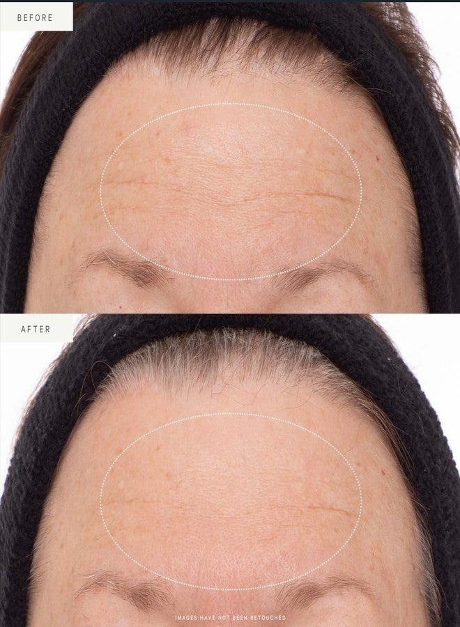 KORA Organics Plant Stem Cell Retinol Alternative Serum, Firming Face Serum, Repair Signs of Aging, Promotes Radiant Skin, Certified Organic, Cruelty Free, Travel Size Anti-Aging Serum, 0.34 fl oz - Image 3