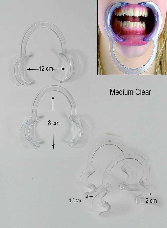 Dentosmile Flexi Premium Cheek/Lip Retractor C-Shape Mouth Opener Size Medium (Clear) (10) - Image 5