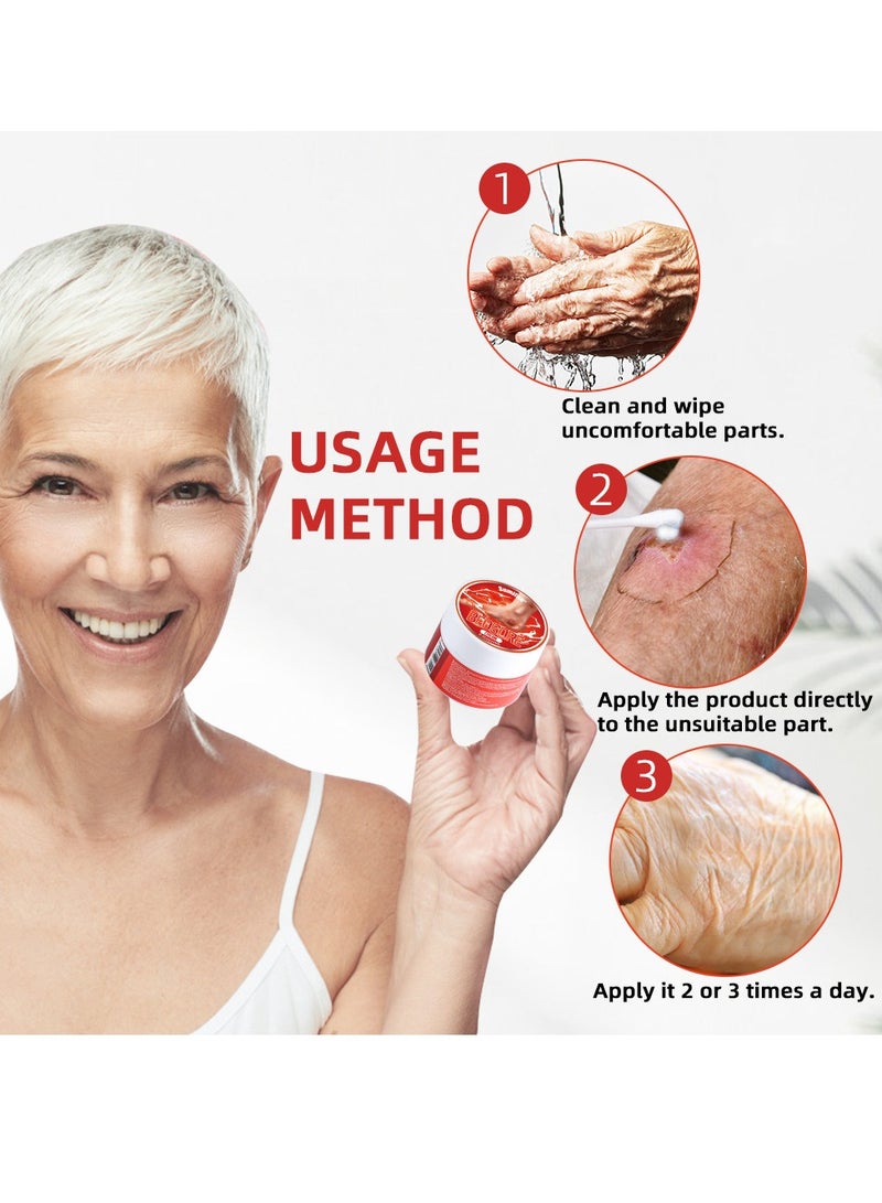 سوميفون كريم قرح الفراش، 3 قطع، سريع الاختراق لإصلاح قرح الفراش، فعال في شفاء قرح الفراش - Image 4