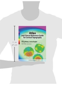Atlas and Clinical Reference Guide for Corneal Topography  - Image 1
