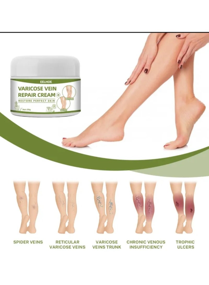 إيلهو كريم الدوالي الأصلي 50 جرام كريم إصلاح الأوردة يخفف من دودة الأرض وعلاج الساقين من الأوردة العنكبوتية العناية بالساق - Image 4